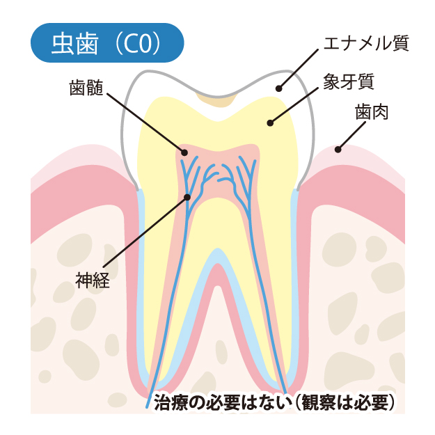 名古屋市守山区の歯医者、もりやまファミリー歯科の一般歯科