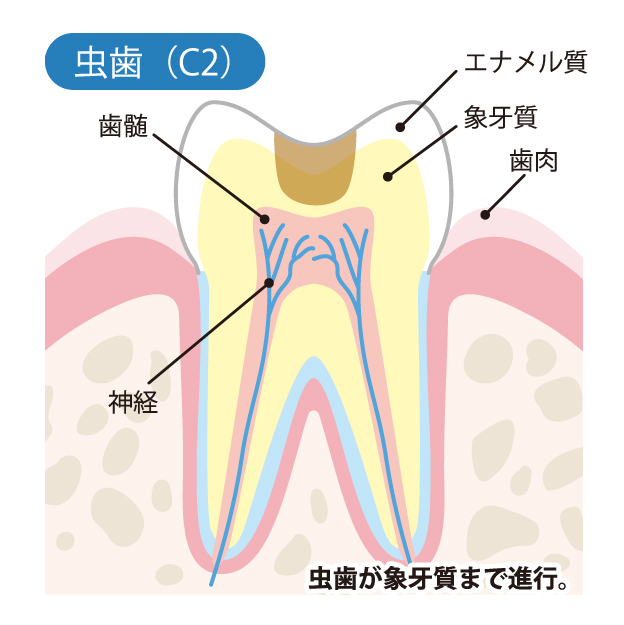 名古屋市守山区の歯医者、もりやまファミリー歯科の一般歯科