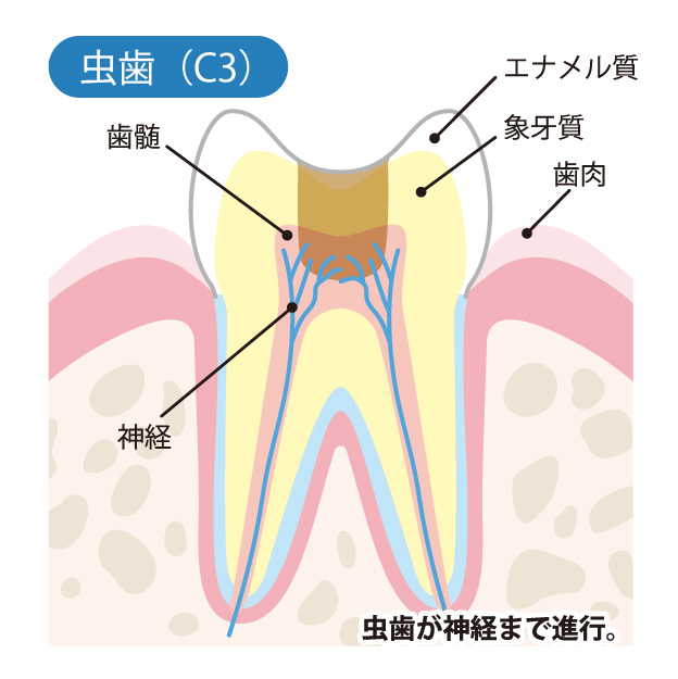 名古屋市守山区の歯医者、もりやまファミリー歯科の一般歯科