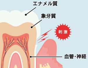 名古屋市守山区の歯医者、もりやまファミリー歯科で自分に合った歯磨剤の選び方